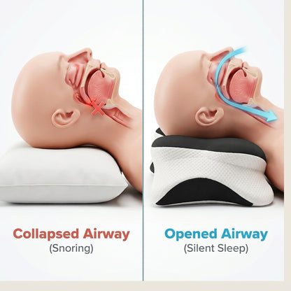 Align - The Anti-snoring Pillow